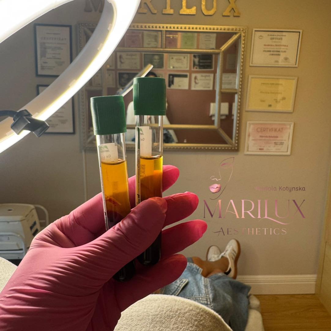 PRP Therapy — platelet rich plasma treatment vials by Marilux Aesthetics
